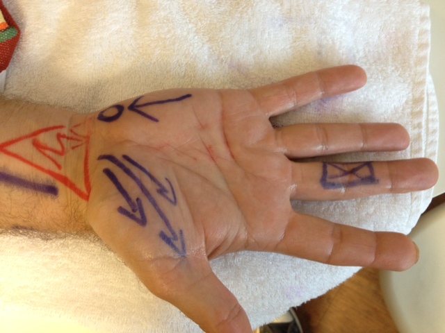 Therapie Voss » Handtherapie